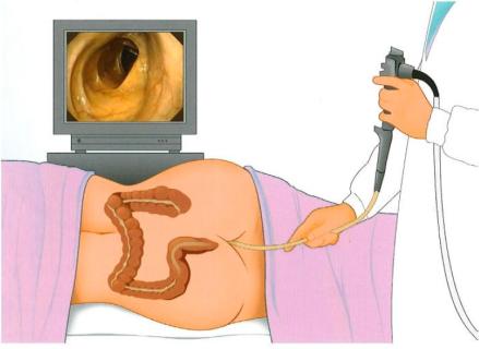 Na ruim 2 maanden weet ik nog niet waar ik aan toe ben